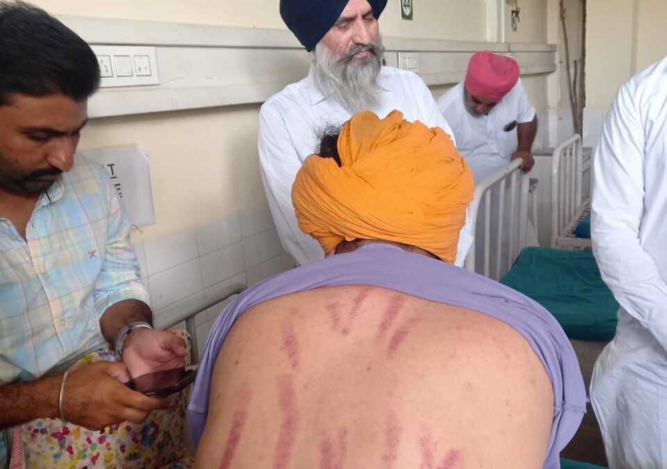 ਰਾਮਪੁਰਾ ਫੂਲ ਤੇ ਸ੍ਰੀ ਮੁਕਤਸਰ ਸਾਹਿਬ ਵਿਖੇ ਸਿੱਖ ਬਜ਼ੁਰਗ ਤੇ ਨੌਜਵਾਨ ਨਾਲ ਕੁੱਟਮਾਰ ਦੇ ਮਾਮਲੇ ’ਚ ਪੁਲਿਸ ਤੁਰੰਤ ਕਰੇ ਸਖ਼ਤ ਕਾਰਵਾਈ- ਜਥੇਦਾਰ ਕੁਲਦੀਪ ਸਿੰਘ ਗੜਗੱਜ